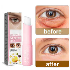 Retinol Eye Cream