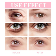 Retinol Eye Cream